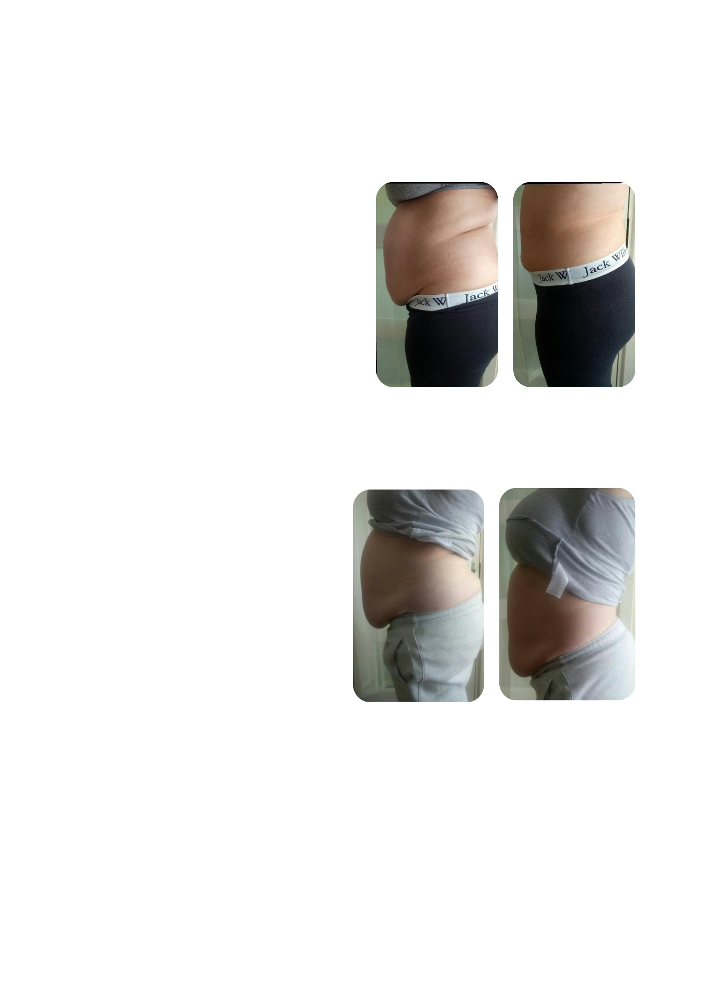 Physique EnhancementV2