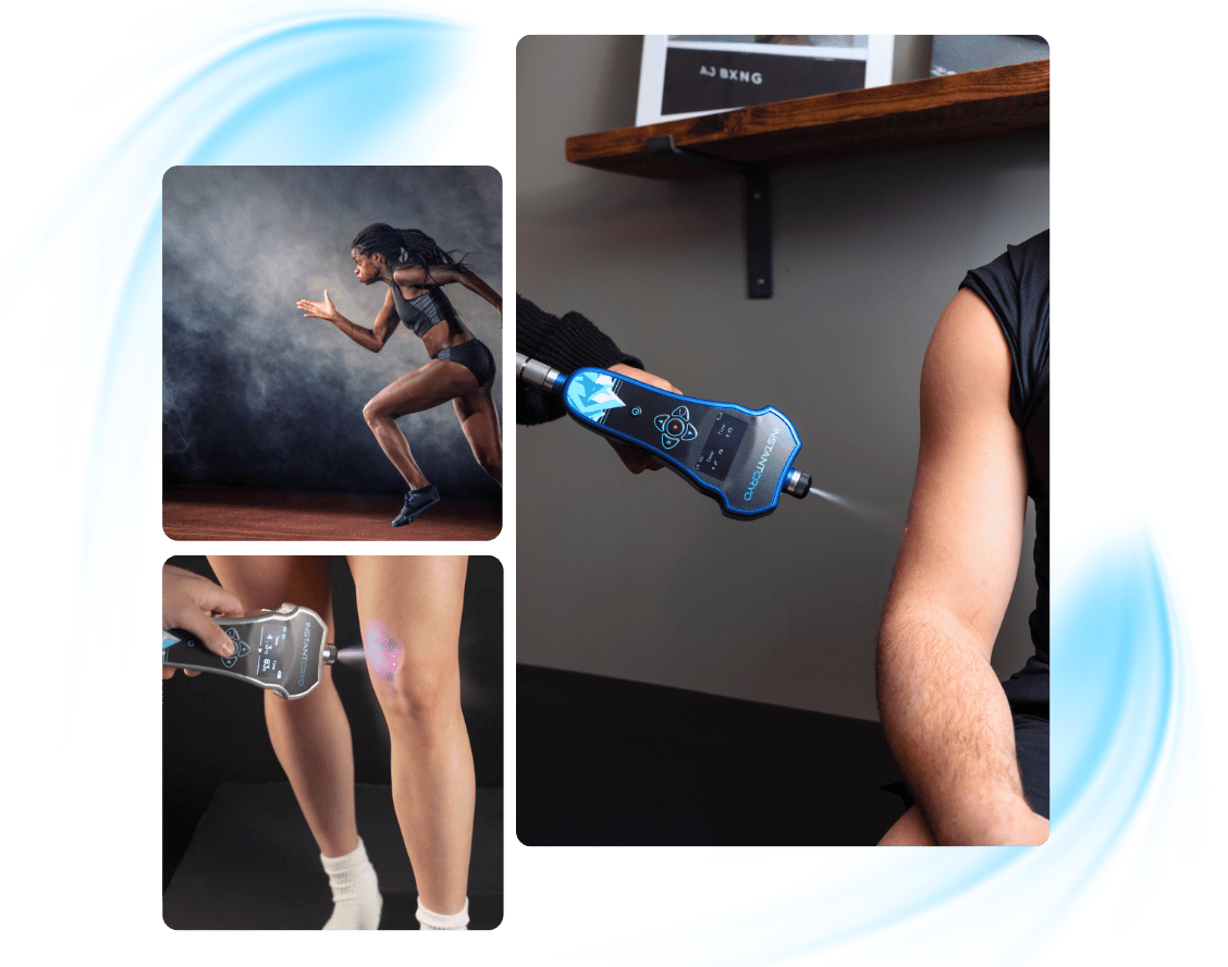Localized cryotherapy treatments are applied to athletes' muscles for sports recovery. 