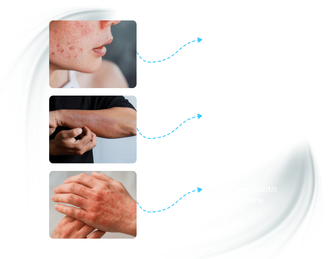 Localized cryotherapy reduces dermatitis symptoms, relieves skin irritation and minimizes scarring.