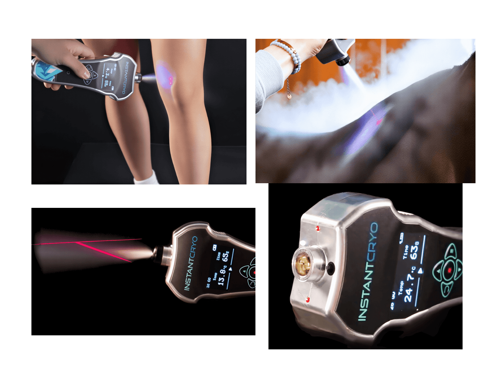 An InstantCryo treatment uses red precision lasers and a blue light indicator for optimal safety.